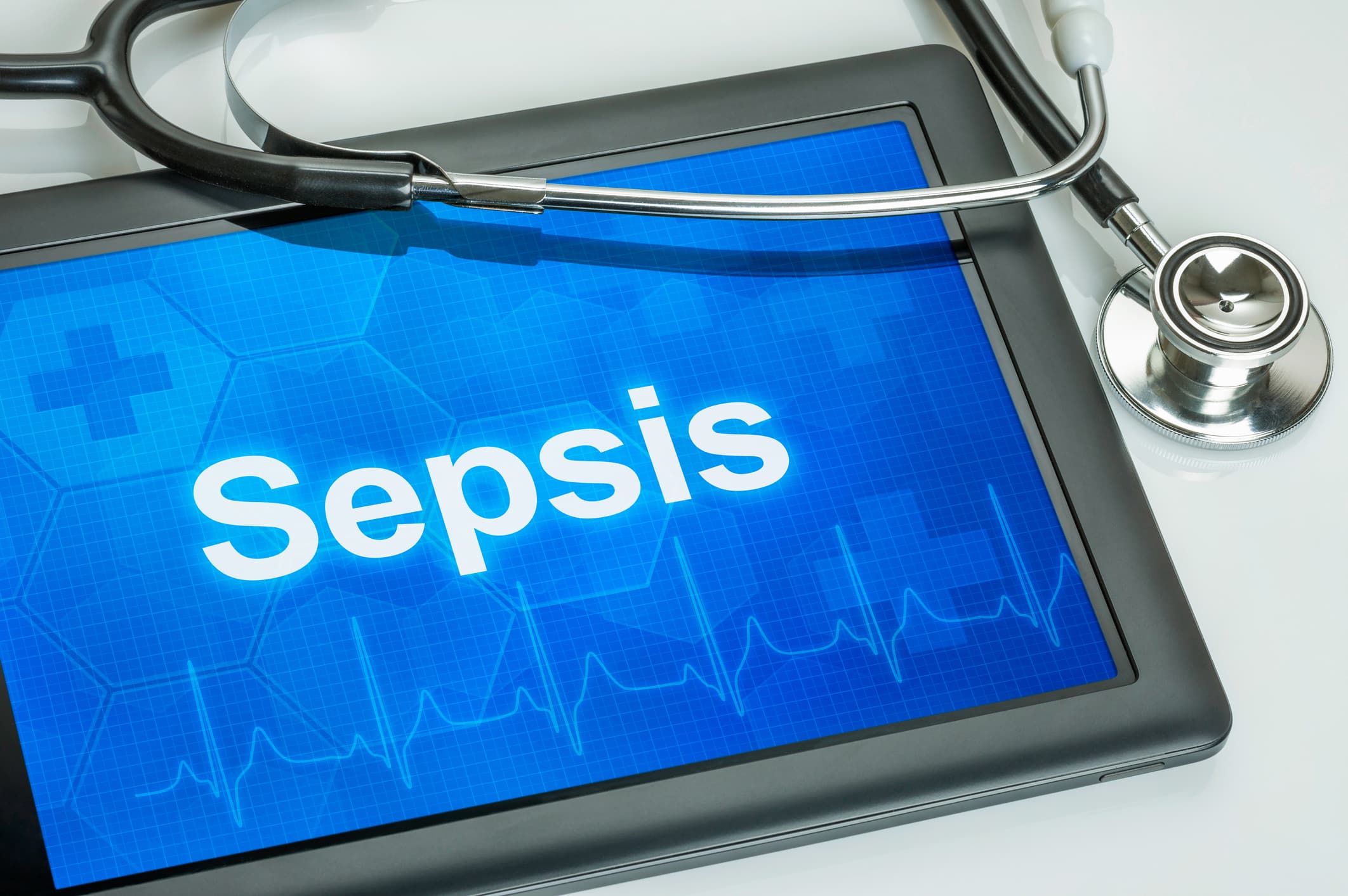 Sepsis written on a tablet